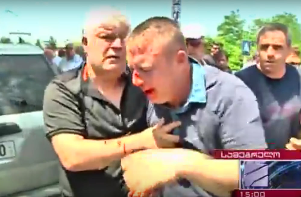 Лидеров "Единого национального движения" избили в Зугдиди