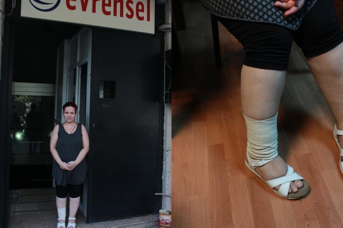 В Стамбуле неизвестные избили беременную журналистку