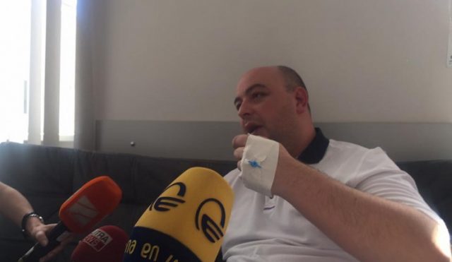 Руководитель Службы государственного аудита Грузии был избит в ночном клубе