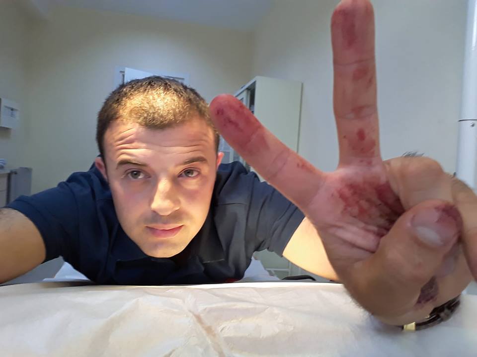 Оппозиционный депутат Бесо Катамадзе был избит в сакребуло Озургетcкого района