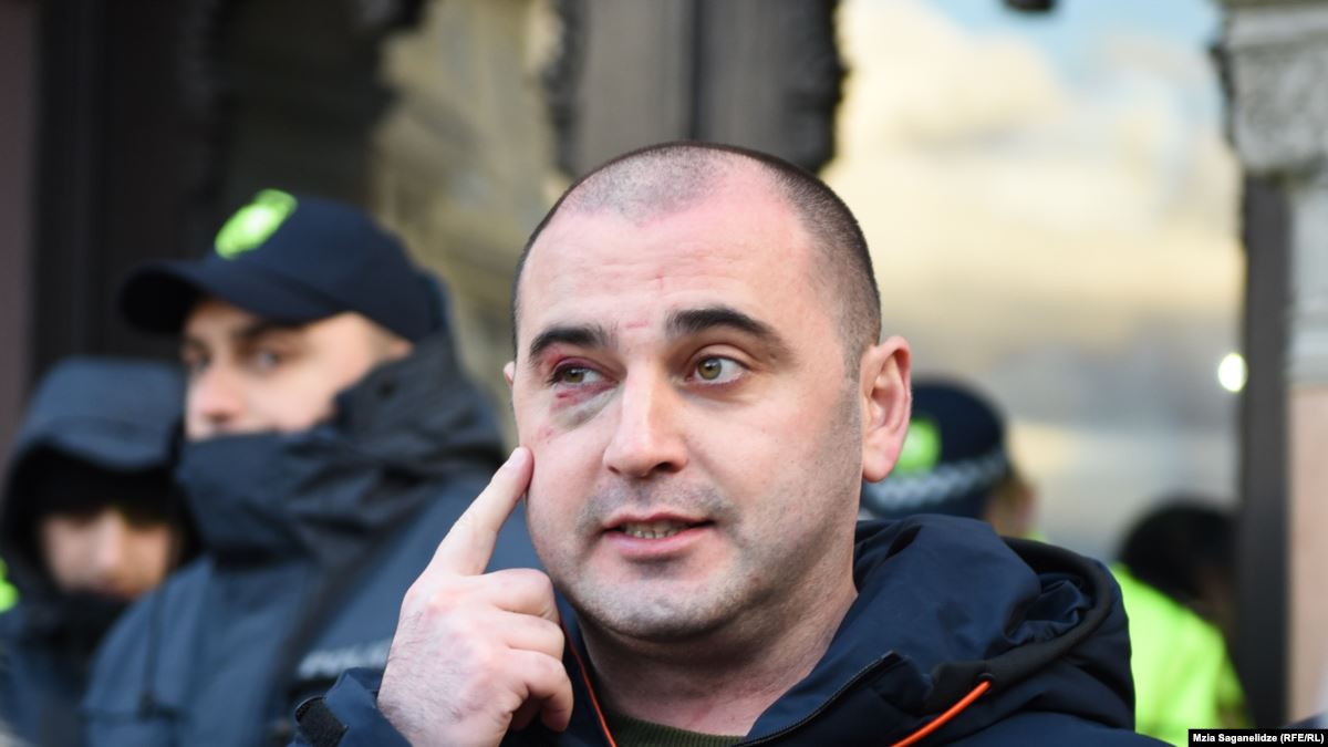 Избитому депутату сакребуло Тбилиси предъявили обвинения в насилии