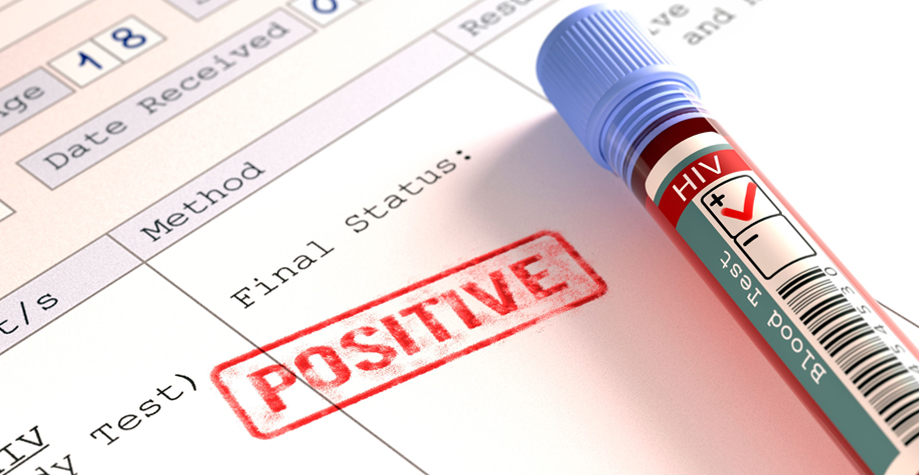 В Грузии новых ВИЧ-инфицированных стало меньше, но общее их число вызывает тревогу