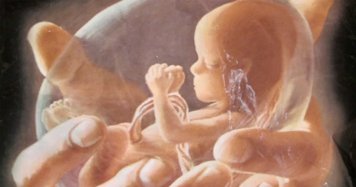 Первая в мире Франция закрепила право на аборт в конституции